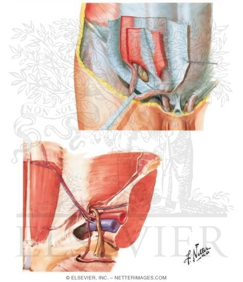 Inguinal Region: Dissections