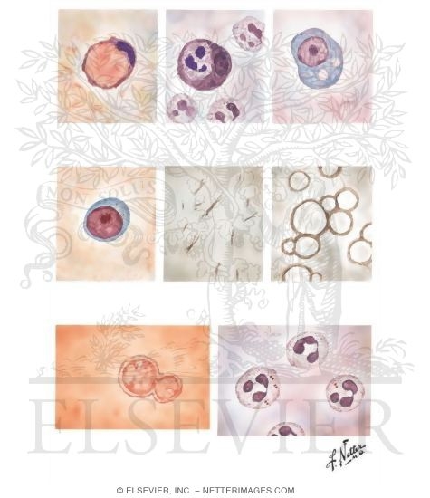 Watermarked preview of unlabeled image: Synovial Fluid Examination