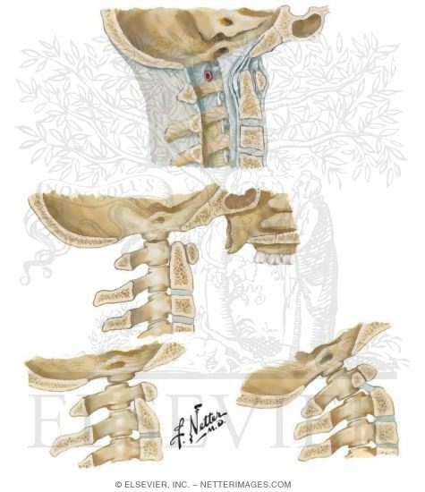 Watermarked preview of unlabeled image: Atlantooccipital Junction
