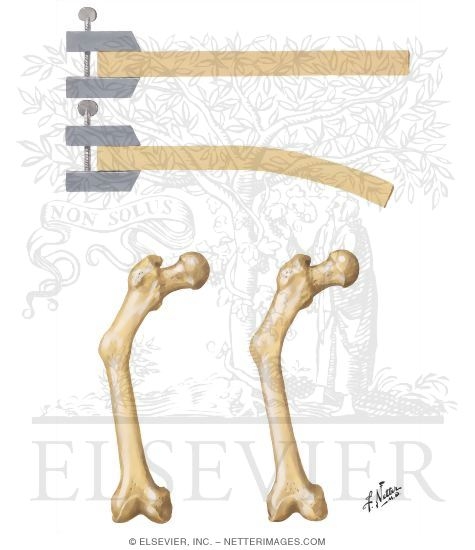 Stress-Generated Electric Potentials in Bone