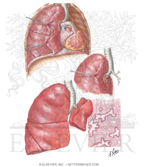 Airway Branching Anomalies