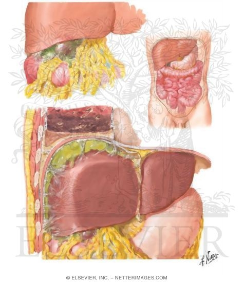 Perforation, Subphrenic Abscess