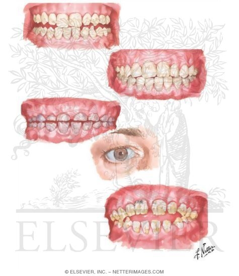 Watermarked preview of unlabeled image: Dental Abnormalities 