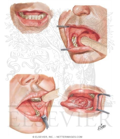 Watermarked preview of unlabeled image: Malignant Tumors I