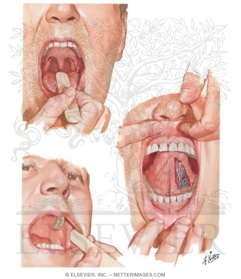 Oral Cavity 
Inspection of Oral Cavity 