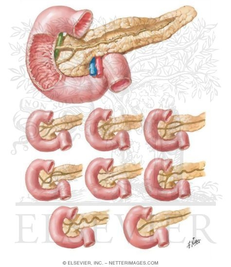 Pancreatic Ducts and Variations
Variations In Pancreatic Ducts