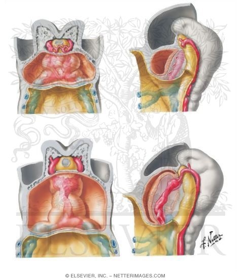 Formation of a Single Heart Tube