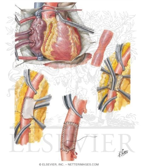 Watermarked preview of unlabeled image: Patch-Graft Reconstruction
