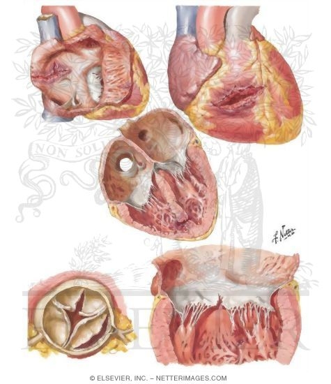 Watermarked preview of unlabeled image: Nonpenetrating Heart Wounds 