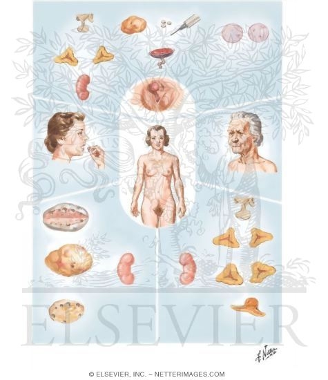 Hirsutism and Virilization