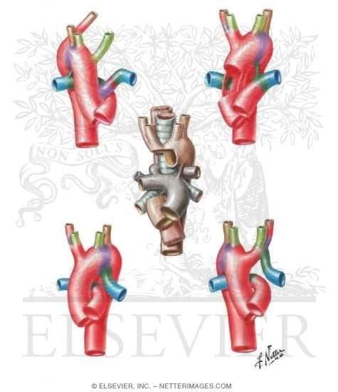 Anomalies of the Aortic-Arch System
