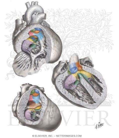 Anomalies of the Right Ventricular - Outflow Tract