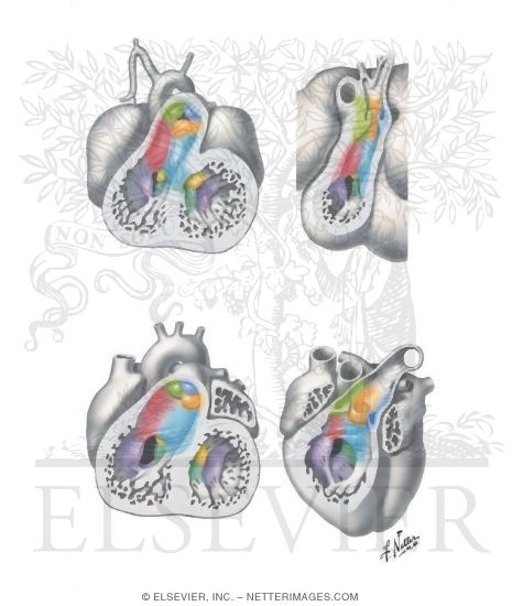 Completion of the Spiral (Aorticopulmonary) Septum