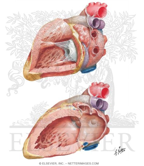 Left Atrium and Left Ventricle