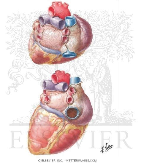Heart: Base and Diaphragmatic Surfaces