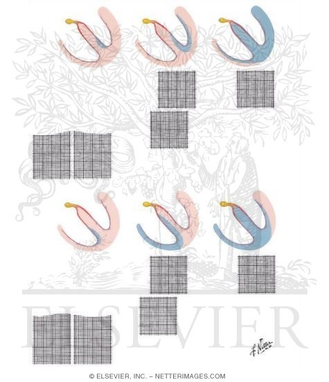 Watermarked preview of unlabeled image: Bundle Branch Block