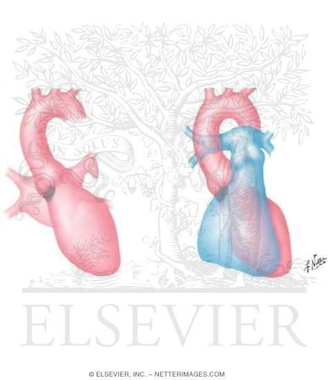 Radiology and Angiocardiography