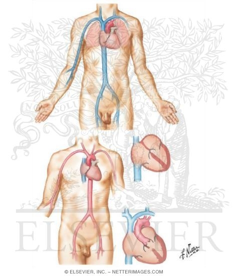 Cardiac Catheterization
