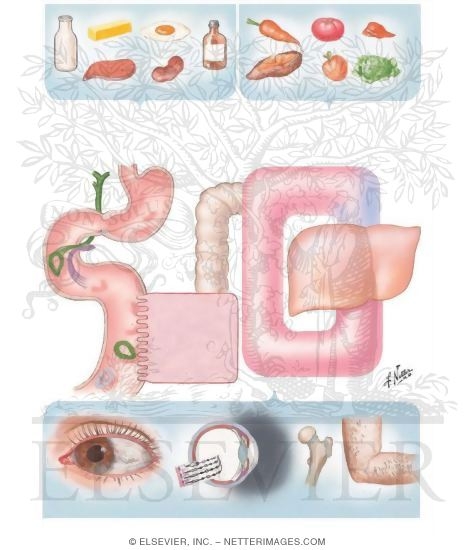 Vitamin A Deficiency