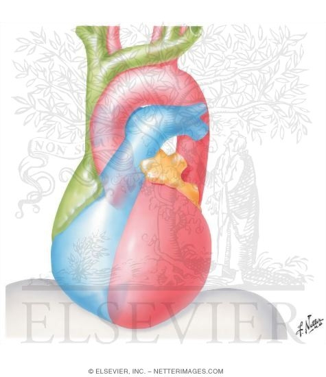 Radiology and Angiocardiography