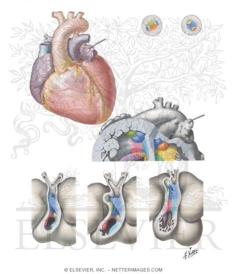 Transposition of the Great Vessels