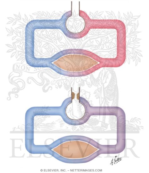 Watermarked preview of unlabeled image: Normal Ventilation