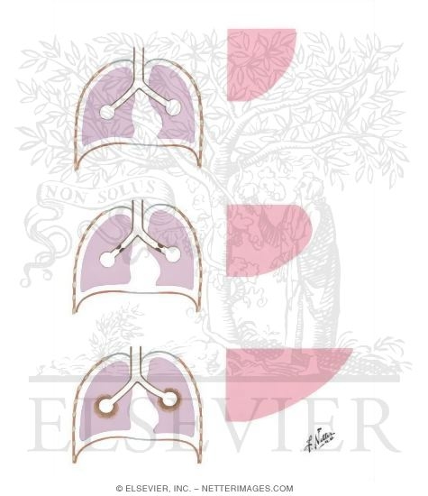 Work of Breathing