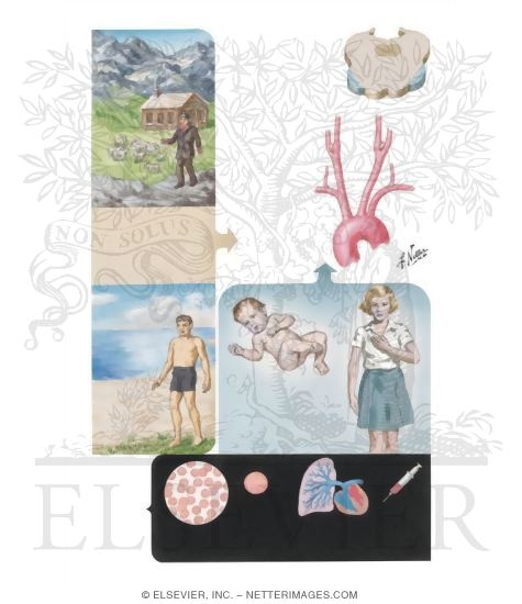 Watermarked preview of unlabeled image: Effects of High Altitude on Respiratory Mechanism