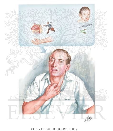 Intrinsic Asthma: Clinical Features