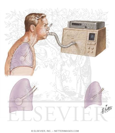 Maximal Expiratory Flow-Volume Curve