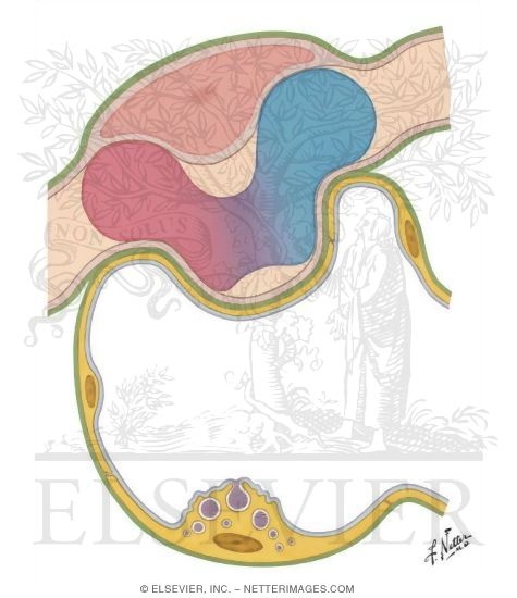 Watermarked preview of unlabeled image: Alveolar - Capillary Relationships at Age 8 Years