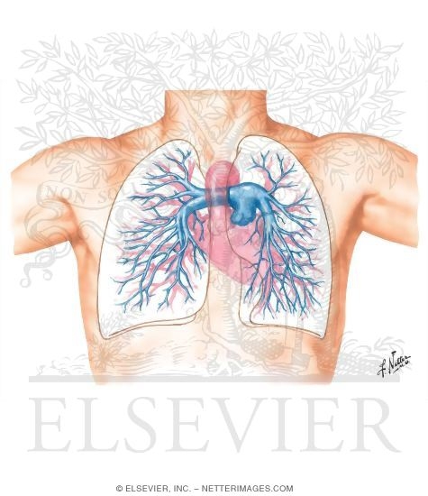 Pulmonary Angiography