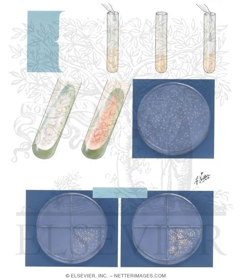 Watermarked preview of unlabeled image: Sputum Culture