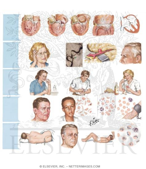 Uncommon Etiologic Mechanisms in Stroke