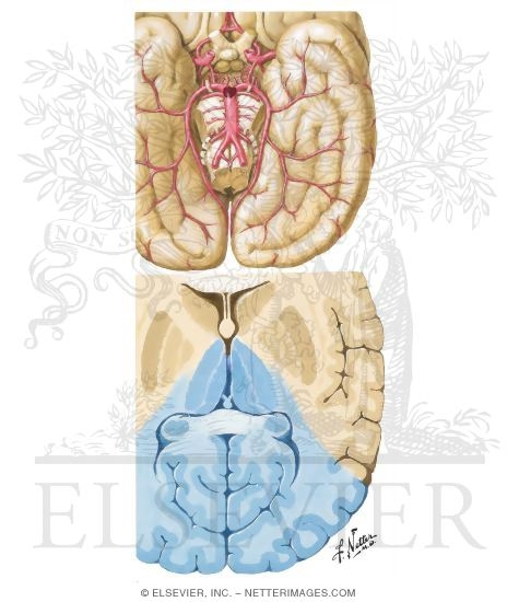 Occlusion of Top of Basilar and Posterior Cerebral Arteries