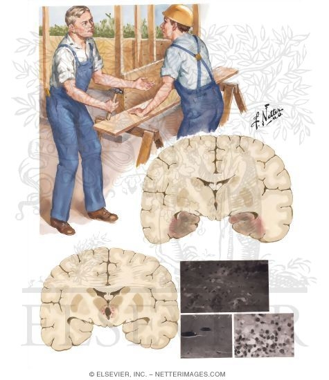 Watermarked preview of unlabeled image: Amnesia