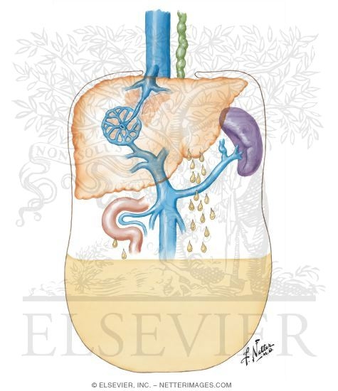 Pathophysiology of Ascites Formation