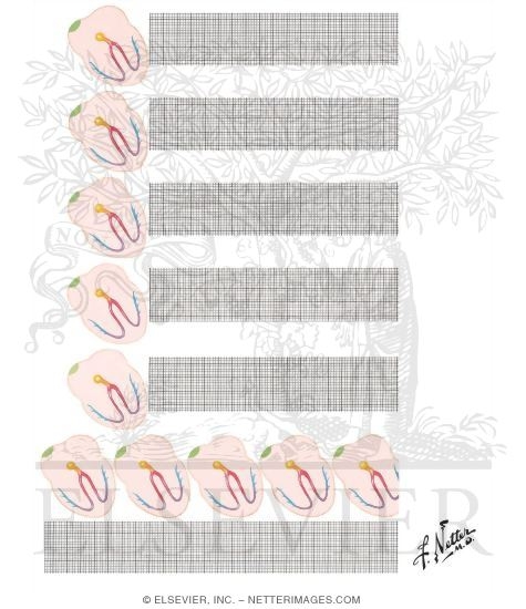 Watermarked preview of unlabeled image: Supraventricular Rhythms