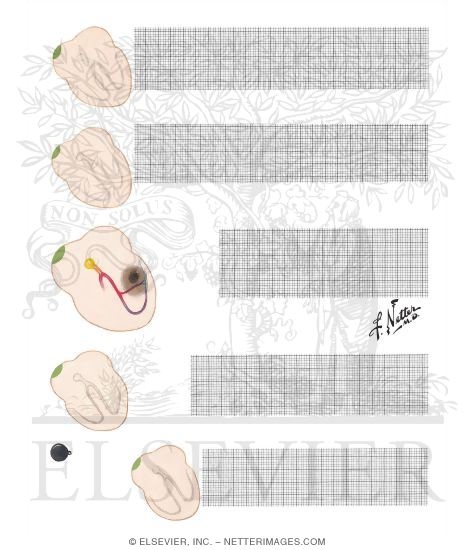 Ventricular Rhythms