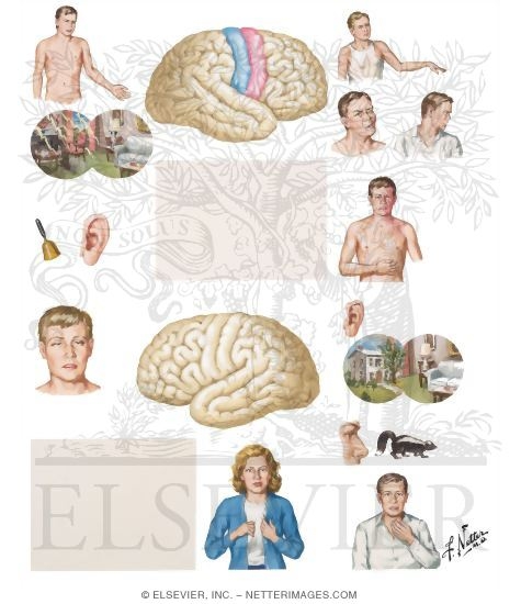 Simple Partial Seizures