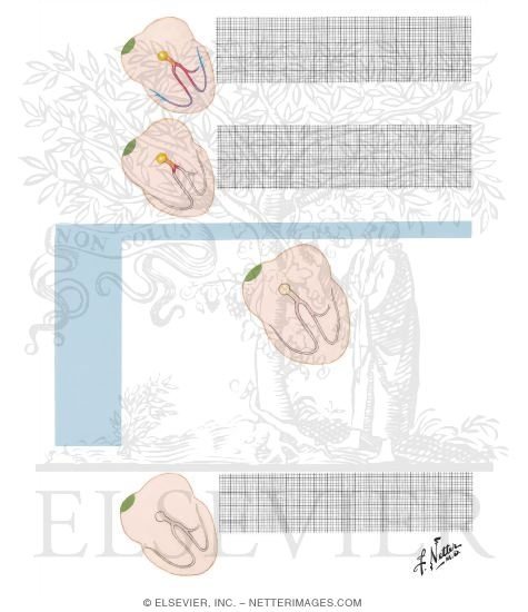 Atrioventricular Conduction Variations