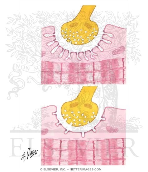 Watermarked preview of unlabeled image: Myasthenia Gravis: Etiologic and Pathophysiologic Concepts