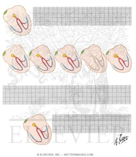 Atrioventricular Conduction Variations