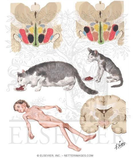 Watermarked preview of unlabeled image: Hypothalamic Control of Appetite