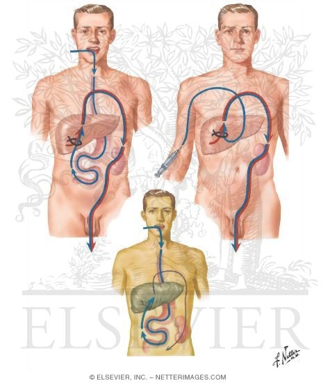 Watermarked preview of unlabeled image: Detoxification: Hippuric Acid Formation