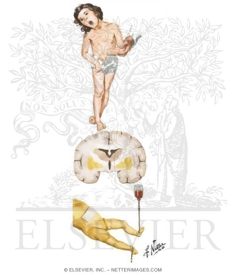 Watermarked preview of unlabeled image: Jaundice in the Neonatal Period