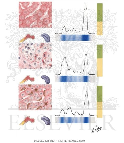 Watermarked preview of unlabeled image: Tests Related to Protein Metabolism (Flocculation, Turbidity and Fractionation Tests)