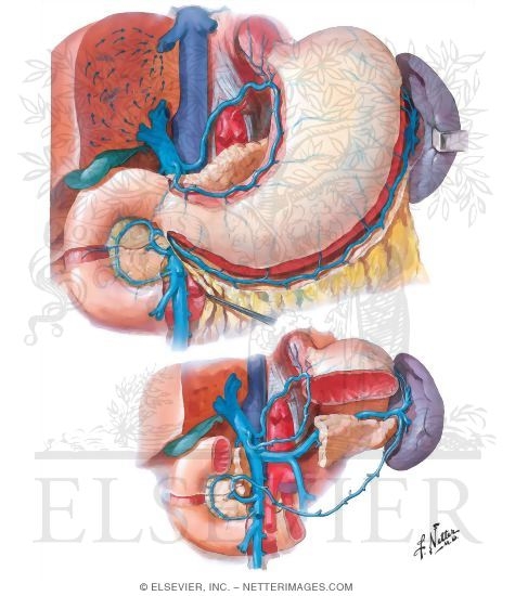 Veins of Stomach, Duodenum, Pancreas and Spleen
Venous Drainage of Stomach and Duodenum