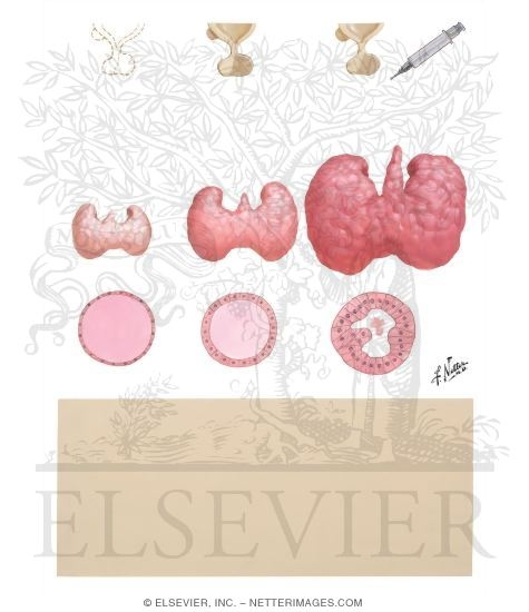 Watermarked preview of unlabeled image: Effect of Thyrotropic Hormone on Thyroid