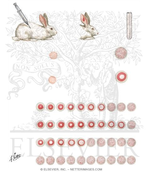 Watermarked preview of unlabeled image: Growth Hormone Assay